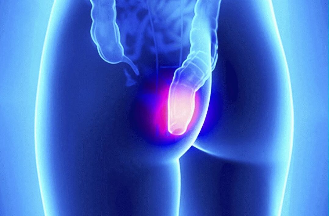 Gelarex se puede utilizar tanto por vía externa como rectal.